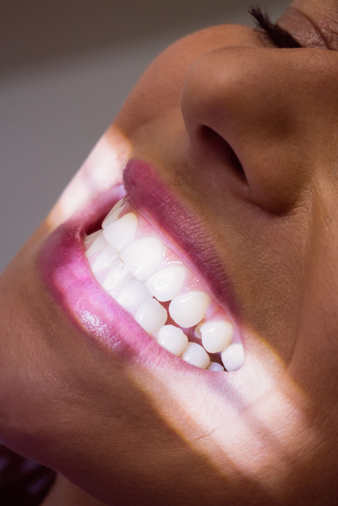 Sbiancamento e igiene dentale presso lo studio Muller di Genova